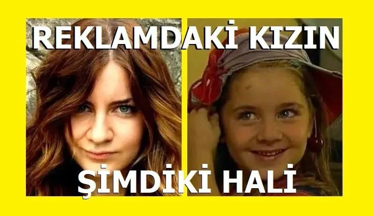 Dalin Reklamlarındaki Bebek Nasıl Öldü