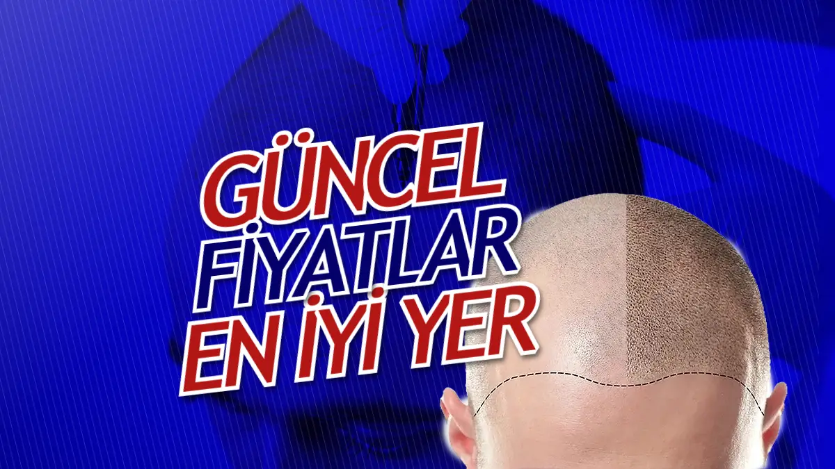 Türkiye’nin en i̇yi saç ekim merkezi