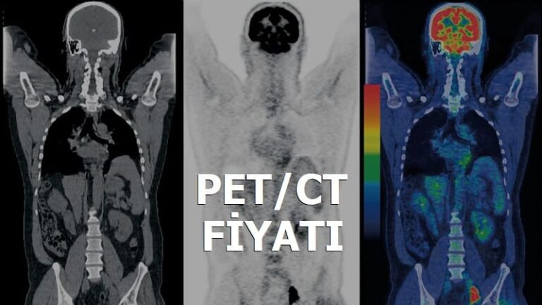 Pet Çekimi Nasıl Yapılır (Fiyatı ve Sonrasındaki Etkileri) - Sağlık