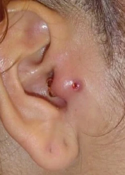 Tragus Sağ mı Sol mu