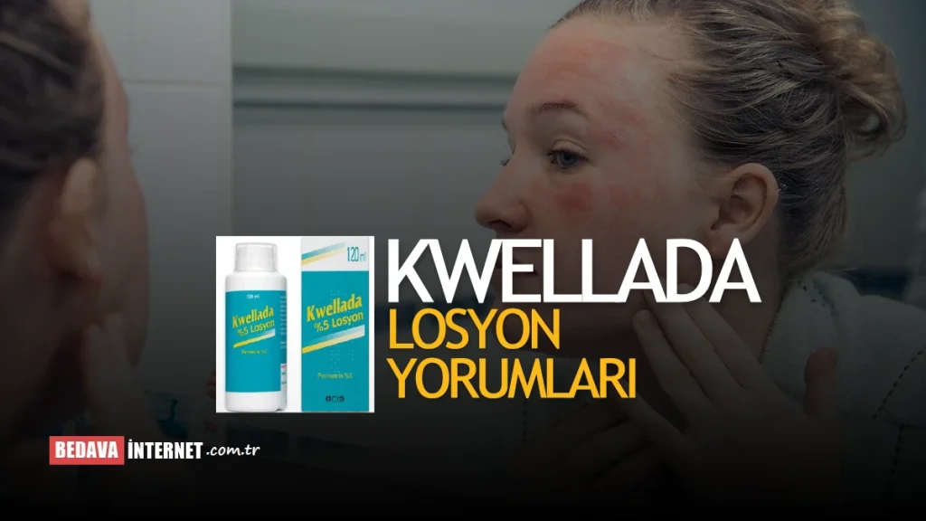 Kwellada Losyon Yorumları