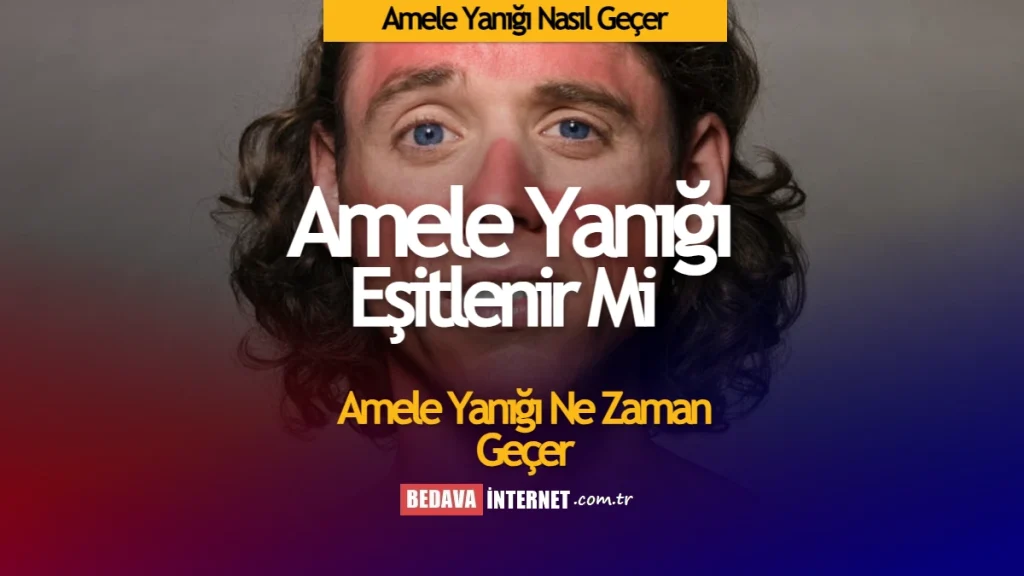 amele yanığı nasıl geçer